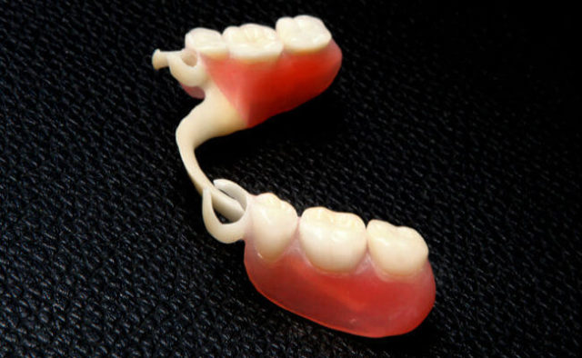 Зубные протезы типа «бабочка»